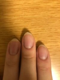 人差し指と薬指のピンクの部分がガタガタ まっすぐで気になります Yahoo 知恵袋