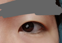 まぶたが薄い一重 重い一重ってどうやったら分かりますか 目を擦ると二重に Yahoo 知恵袋