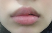 唇の腫れについて上唇が左半分 下唇が全体的に腫れるという事が数週間に一回 Yahoo 知恵袋