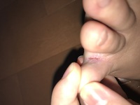 足の薬指と小指の間がパックリと割れて痛いです これは水虫でしょうか この Yahoo 知恵袋