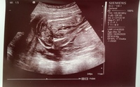 こちらのエコーは女の子ですか 男の子ですか 妊娠7ヶ月目 24 Yahoo 知恵袋