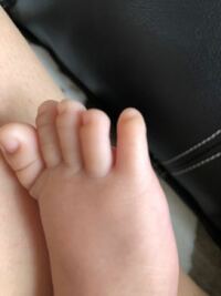 生後2ヶ月の赤ちゃんです 足の薬指が小指よりも短いです何かの病気でし Yahoo 知恵袋