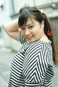 太っている人の首の後ろの隆起は何ですか 肉でしょという人がいるので Yahoo 知恵袋