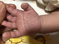 生後2週間の新生児の息子の右手だけにますかけ線 の手相がありま Yahoo 知恵袋