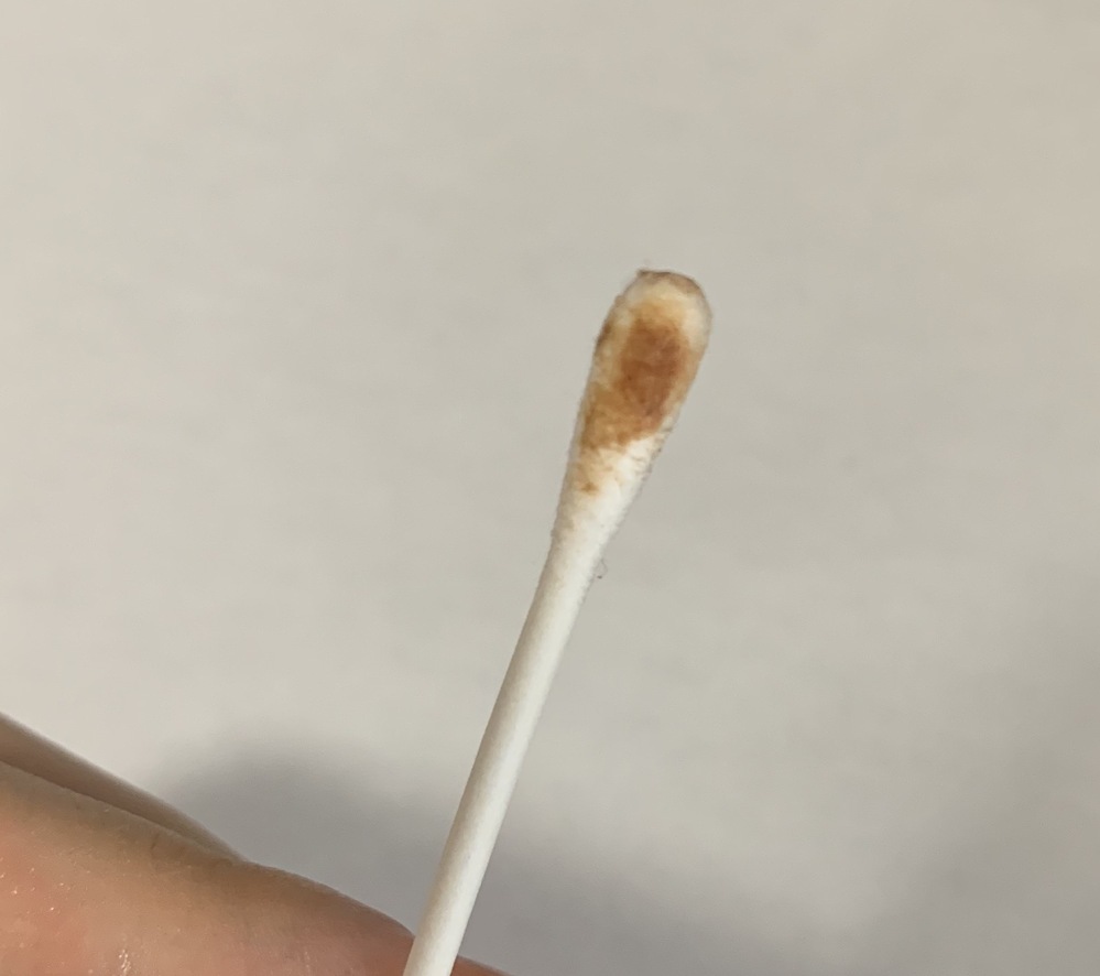 耳の症状について詳しい方お願い致します 汚い写真失礼しました Yahoo 知恵袋