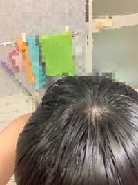 薄毛についての悩みです 本当に最近ストレスを抱え込んでいて薄毛 Yahoo 知恵袋