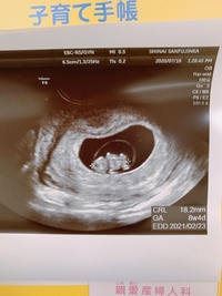 はじめまして現在9wに入った妊婦です 出産経験無しですこの前妊婦検診でエ Yahoo 知恵袋