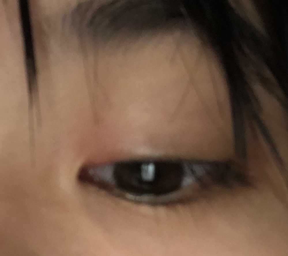 痛み 精液 なし 茶色