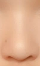 10kg痩せたら鼻も痩せますか 私は団子鼻であぐら鼻ですが痩せたら小鼻が Yahoo 知恵袋