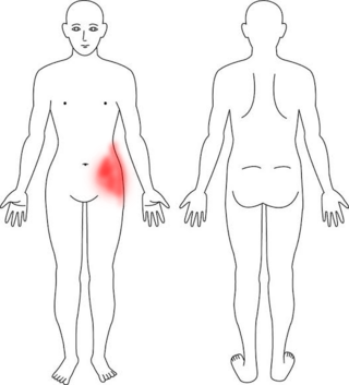 コルセットダイエットの危険性 くびれを得るために失うもの 臨床ブロガー