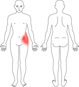 コルセットダイエット 危険性