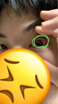 角膜炎 になりました 今日は一日中暗い部屋でスマホも見ないで眼帯を Yahoo 知恵袋