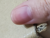 爪の上の白い部分が爪にもう1つ出来たように 白い線があります 二枚爪でし Yahoo 知恵袋
