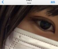 私の目は 末広二重の上に並行二重が重なっている三重まぶたです 生まれつ Yahoo 知恵袋