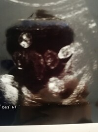 性別ショック 三人目妊娠中です 上二人が男の子の年子で今回は4年ぶり Yahoo 知恵袋