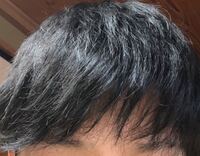 男で前髪が割れるのってカットの問題ですか 割れる度合いがひどいのですが Yahoo 知恵袋