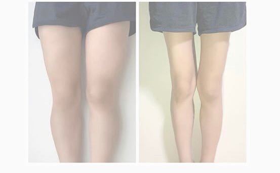 男性の方はどっちの脚が好きですか 左 女性が右見て 細くて良 Yahoo 知恵袋