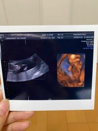 今妊娠17週です 最後に検診した時は13週でした その時 Yahoo 知恵袋