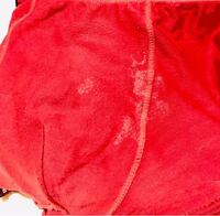 旦那のパンツのシミ テカテカとした白いものがついてました 浮気ですか Yahoo 知恵袋