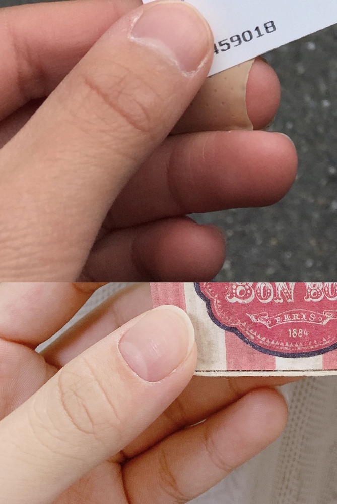 上の画像ってマムシ指ですか 下の画像が今の私の指です 甘皮処理 Yahoo 知恵袋