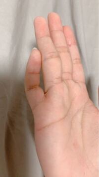 指を伸ばしても画像のように小指だけ伸びないんですけど何でなんでしょうか Yahoo 知恵袋