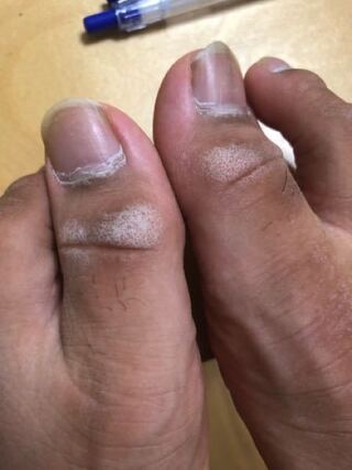 オーガニック 何でも 店主 足 親指 水虫 Kankyohokoku Jp