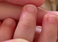 赤ちゃんを産んだ人に質問です 新生児の時はすごく綺麗な爪をしていたのです Yahoo 知恵袋