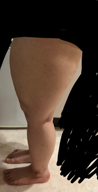 大変お見苦しい写真載せます私はとてつもなくふとももが太いです 全身ふと Yahoo 知恵袋