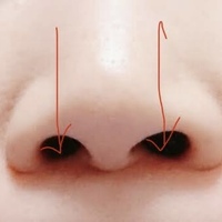 鼻の穴について質問です 鼻の中の下辺りが臭いのですが同じ方いませんか 本 Yahoo 知恵袋