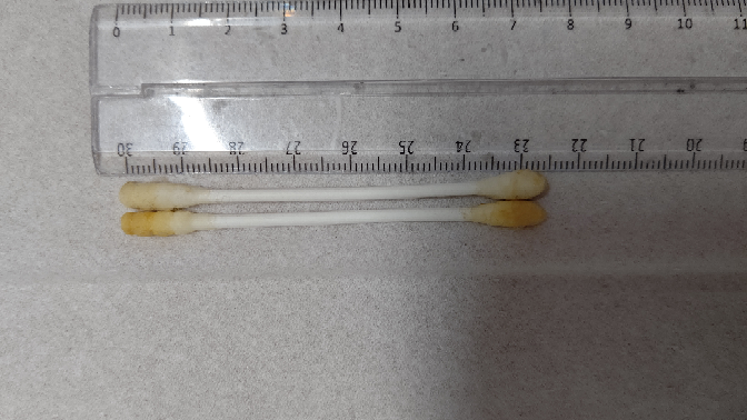 汚い話ですみません 耳垢がヤバい気がします 耳鼻科に行ったほうがいい Yahoo 知恵袋