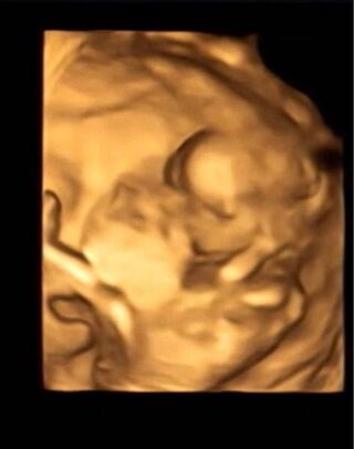 15週3日の4dエコーの写真です 早い時期に性別は言わない主義のク Yahoo 知恵袋