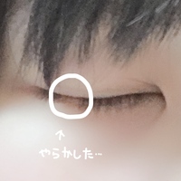 ストレスなのか何なのかよく分からないのですが まつ毛や眉毛 頭 Yahoo 知恵袋