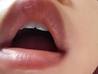 1歳3ヶ月の子の前歯の先が白いです これは虫歯ですか ま Yahoo 知恵袋