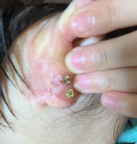 ピアスのホールについての質問です 開けてから2ヶ月経ちま Yahoo 知恵袋