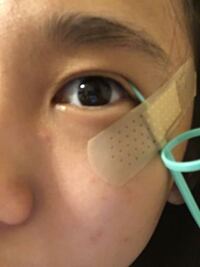 二重になる方法をsnsで 調べたら アイプチで使うプッシャ Yahoo 知恵袋