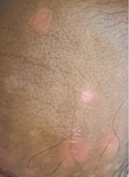 男性の病気 すべての質問 Yahoo 知恵袋