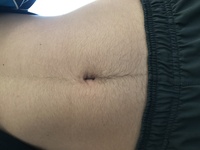 中学生3年生の男です 腹にも毛が生えてきました 修学旅行 Yahoo 知恵袋