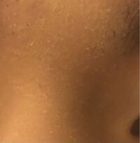 Bbクリームを塗ると肌が垢のようにポロポロむけてきます。また、その上からパ... - Yahoo!知恵袋