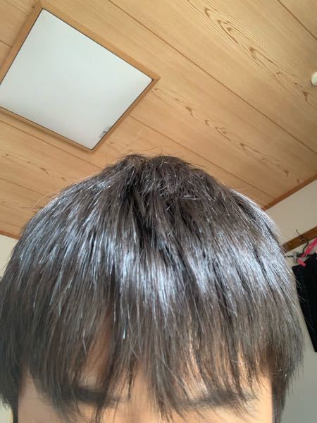 中学生です 前髪から禿げてきたと思います親にも相談出来て Yahoo 知恵袋