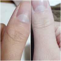 今流行ってる 親指のシワが運命の人のイニシャルって言うやつで私なんか書い Yahoo 知恵袋