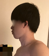 アデノイド顔貌でしょうか それともフェイスラインが汚いだけです Yahoo 知恵袋