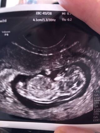 現在11週です ベビーナブで性別はわかりますか Yahoo 知恵袋