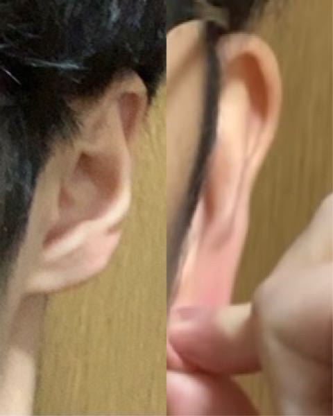 が ポコポコ 鳴る ストレス 耳
