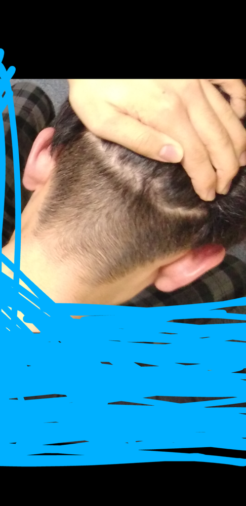 刈り上げは何ミリくらいで短めですかそれとも長めですか また 刈り上げた範 Yahoo 知恵袋