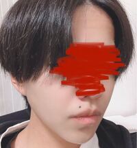 写真あり 口元のほくろがコンプレックスです 除去も考えています Yahoo 知恵袋