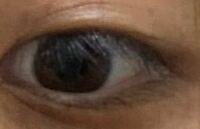 これは私の左目ですが 私の目は色素が濃いほうですか 薄いほうですか ちな Yahoo 知恵袋