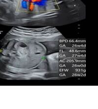 知り合いにエコーの顔がでかいから なんかの障害では と言われました Yahoo 知恵袋