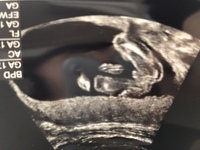 現在妊娠16週4日です これはやはり男の子でしょうか 出来れば Yahoo 知恵袋