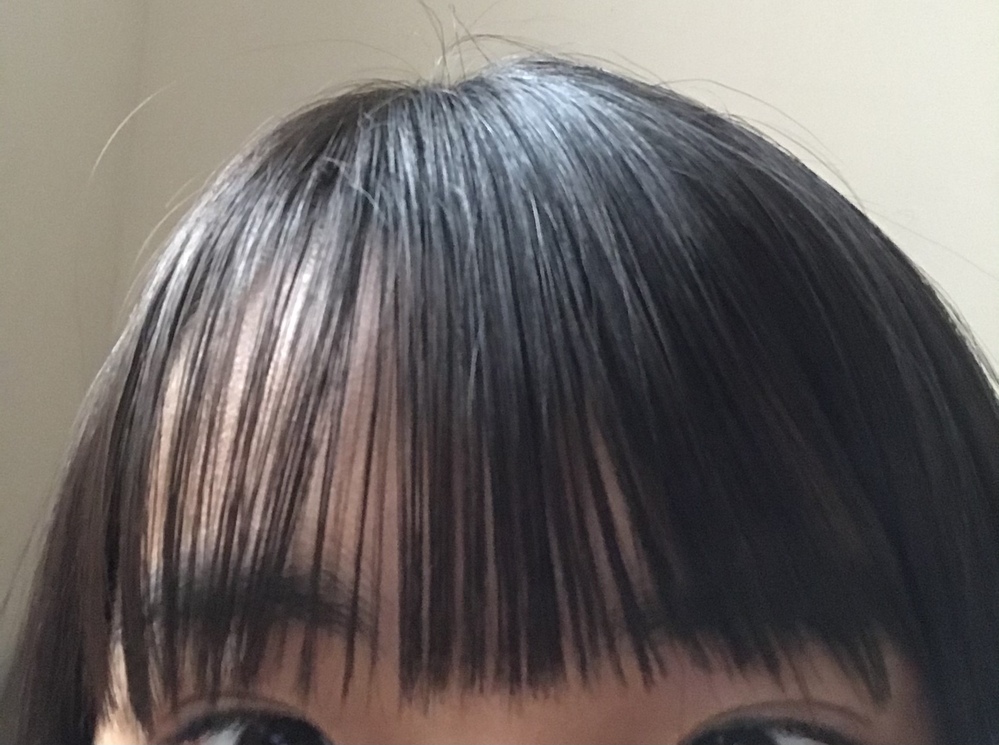 前髪が非対称で一部だけ浮いてしまうくせがあるのがとてもコンプレックスです Yahoo 知恵袋