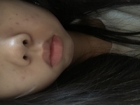 豚鼻がコンプレックスで仕方ありません 私の鼻は 今までこれ以 Yahoo 知恵袋